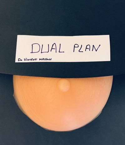 dual plan augmentation mammaire