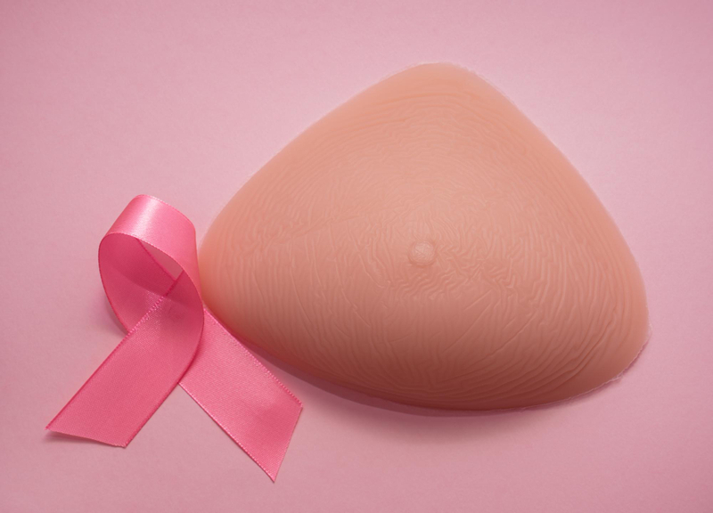 Ablation du sein et remplacement par un sein en silicone