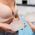 Vagues sur implants mammaires : comment les corriger (et faut-il toujours le faire) ?