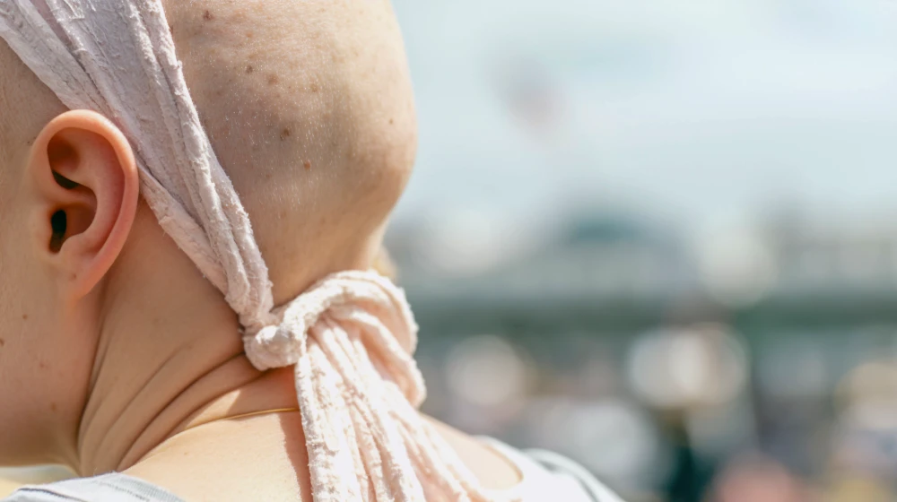 Femme portant un foulard pour protéger sa peau après un traitement contre le cancer du visage.