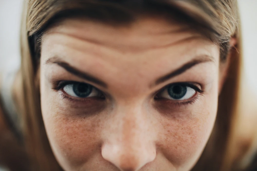 Gros plan sur des cernes creux sous les yeux, associés à la fatigue.